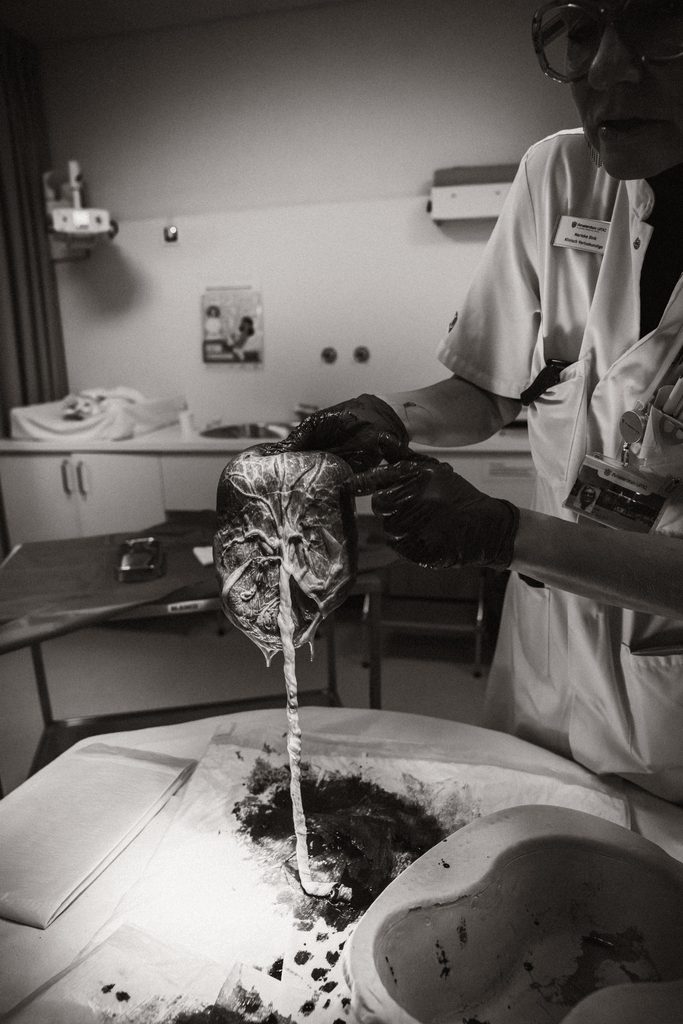 Hospital delivery room during an induction, black and white, birth at the AMC Amsterdam with doula support